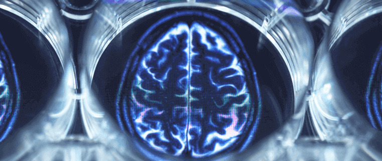 ¿Está protegida la actividad cerebral?